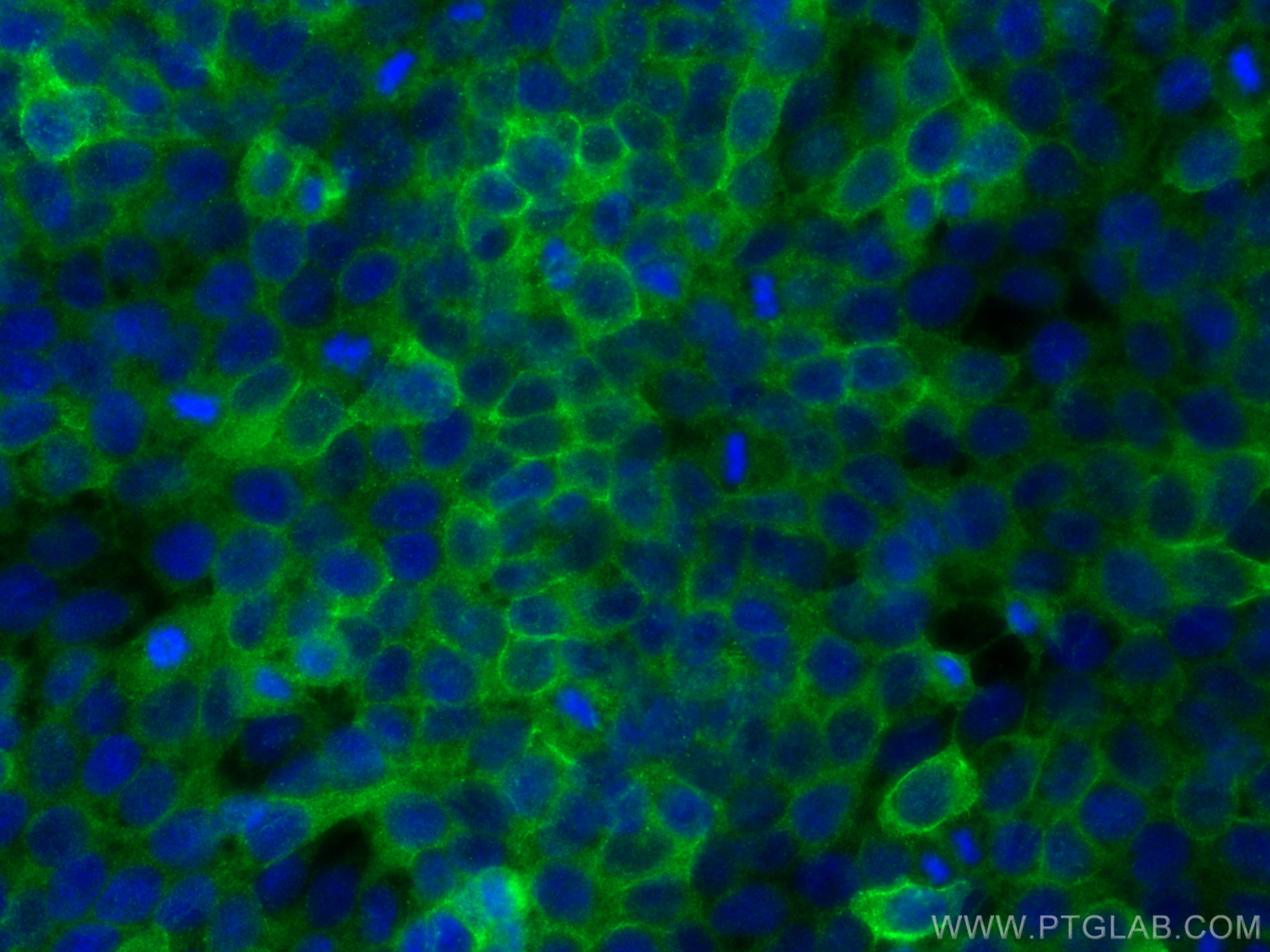 IF Staining of HaCaT using 31190-1-AP