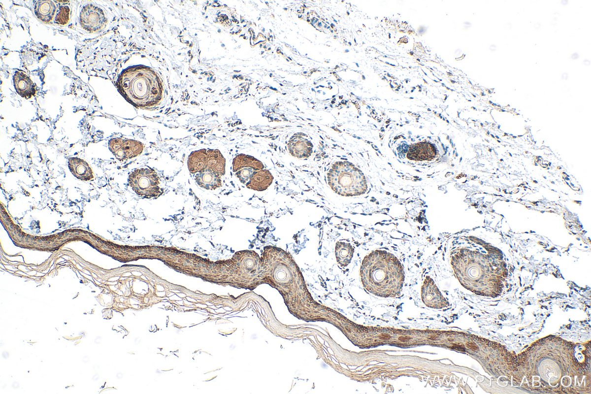 IHC staining of rat skin using 31190-1-AP