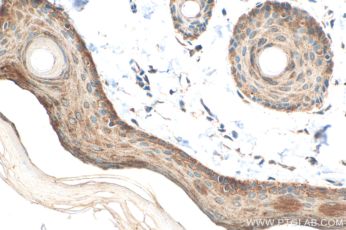 IHC staining of rat skin using 31190-1-AP