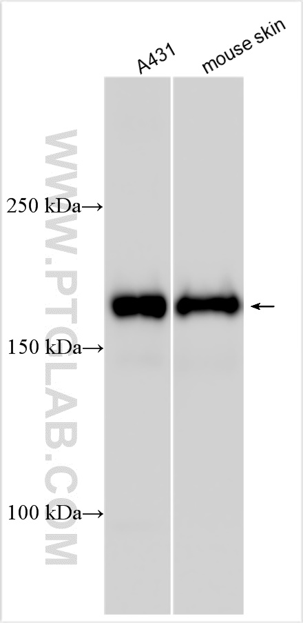 WB analysis using 31190-1-AP