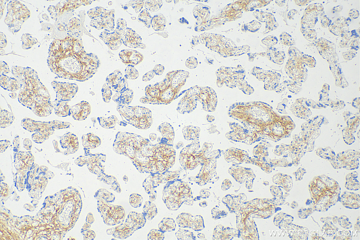 IHC staining of human placenta using 14695-1-AP