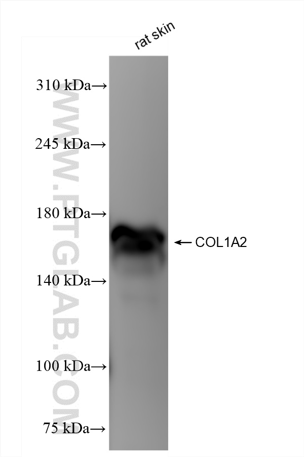 WB analysis of rat skin using 83752-3-RR (same clone as 83752-3-PBS)