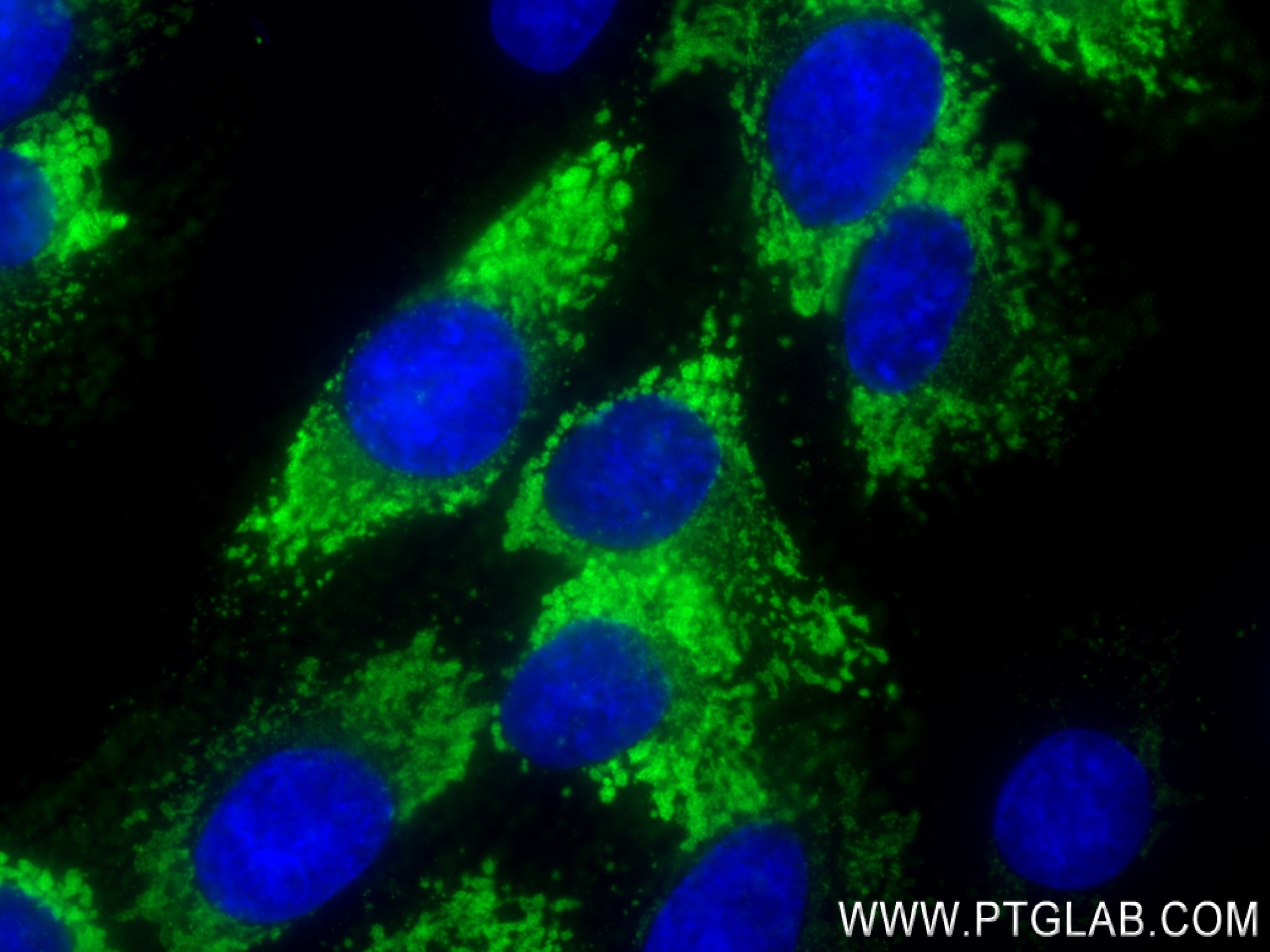 IF Staining of HSC-T6 using 83752-5-RR (same clone as 83752-5-PBS)