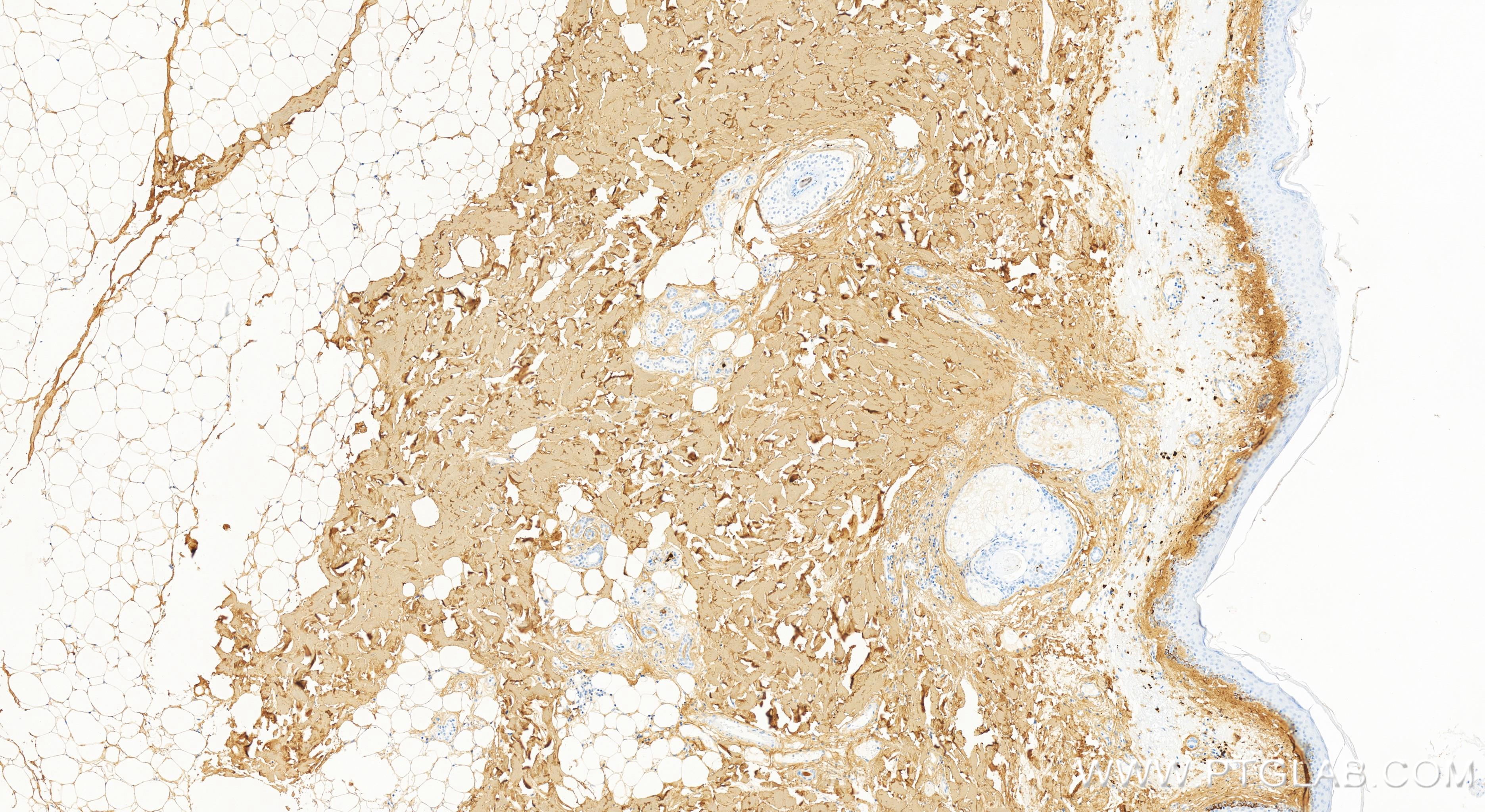 IHC staining of human skin using 83752-5-RR (same clone as 83752-5-PBS)