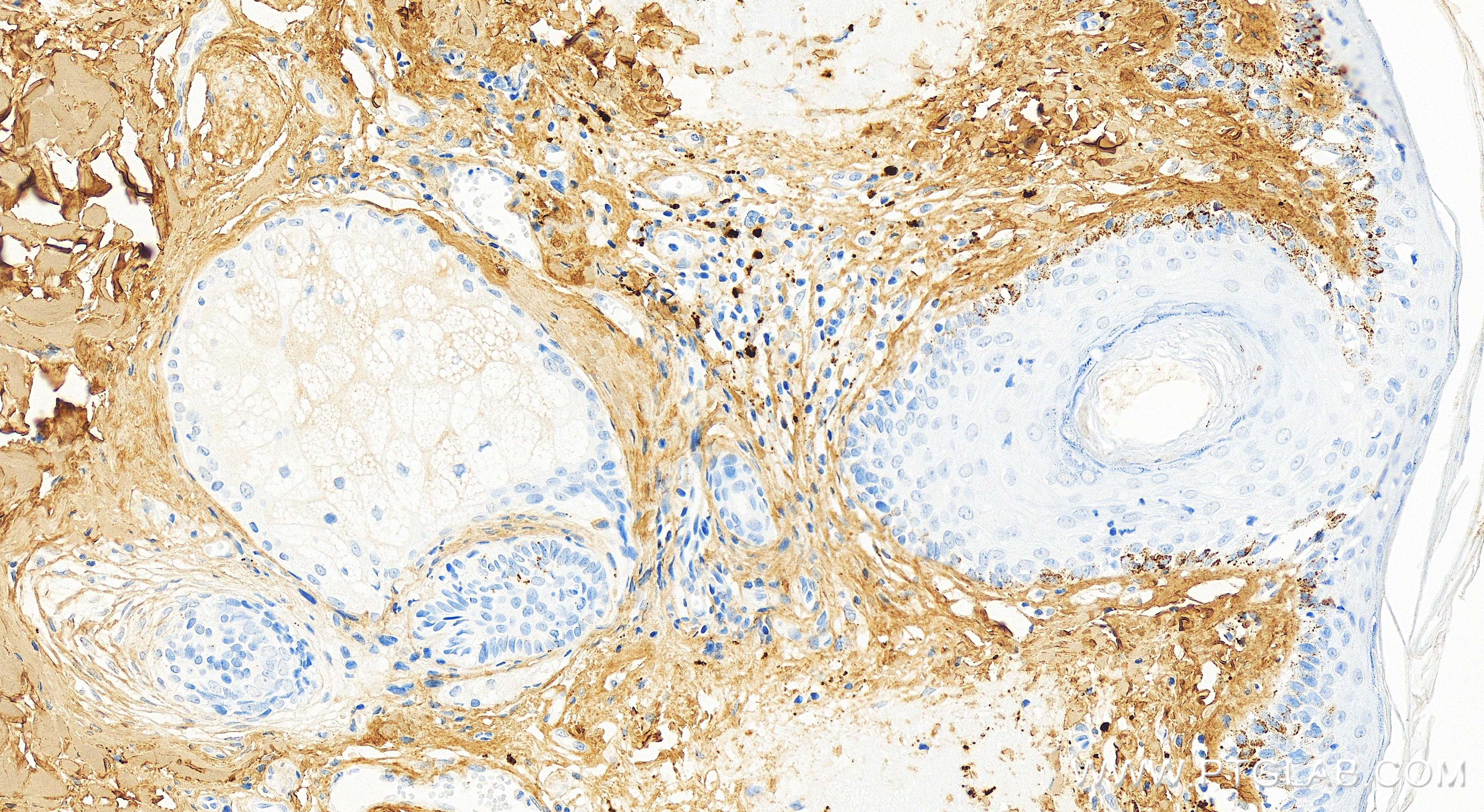 IHC staining of human skin using 83752-5-RR (same clone as 83752-5-PBS)