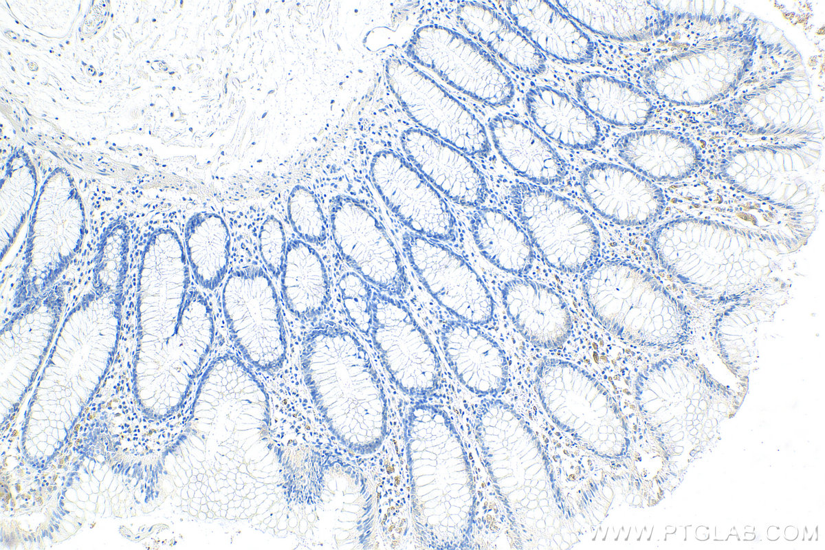 IHC staining of human colon using 14337-1-AP