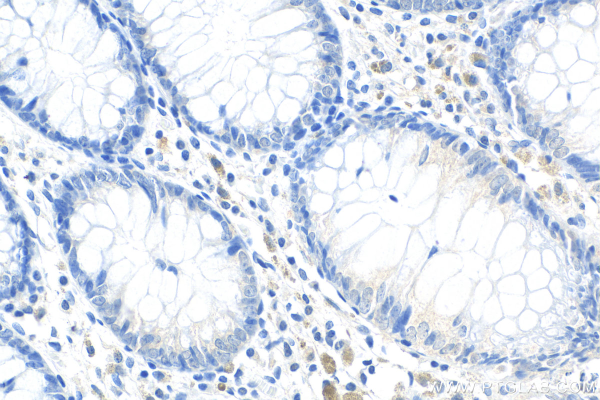 IHC staining of human colon using 14337-1-AP