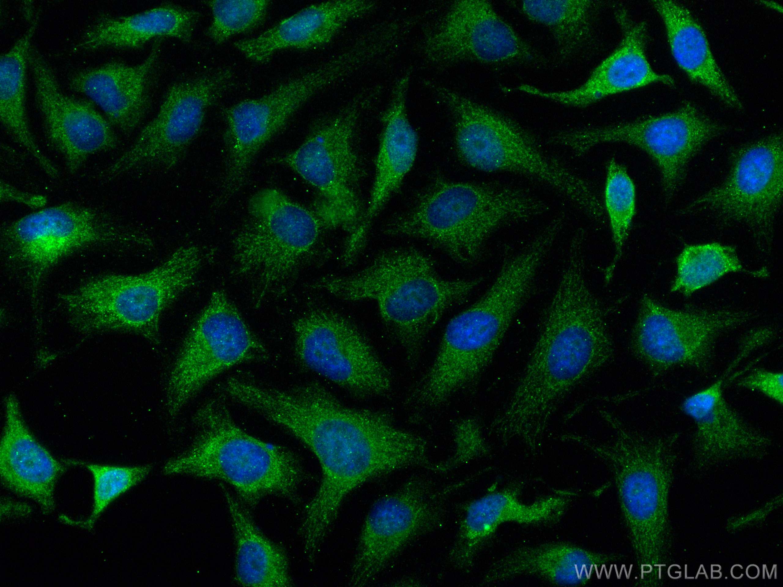 IF Staining of HeLa using 12738-1-AP