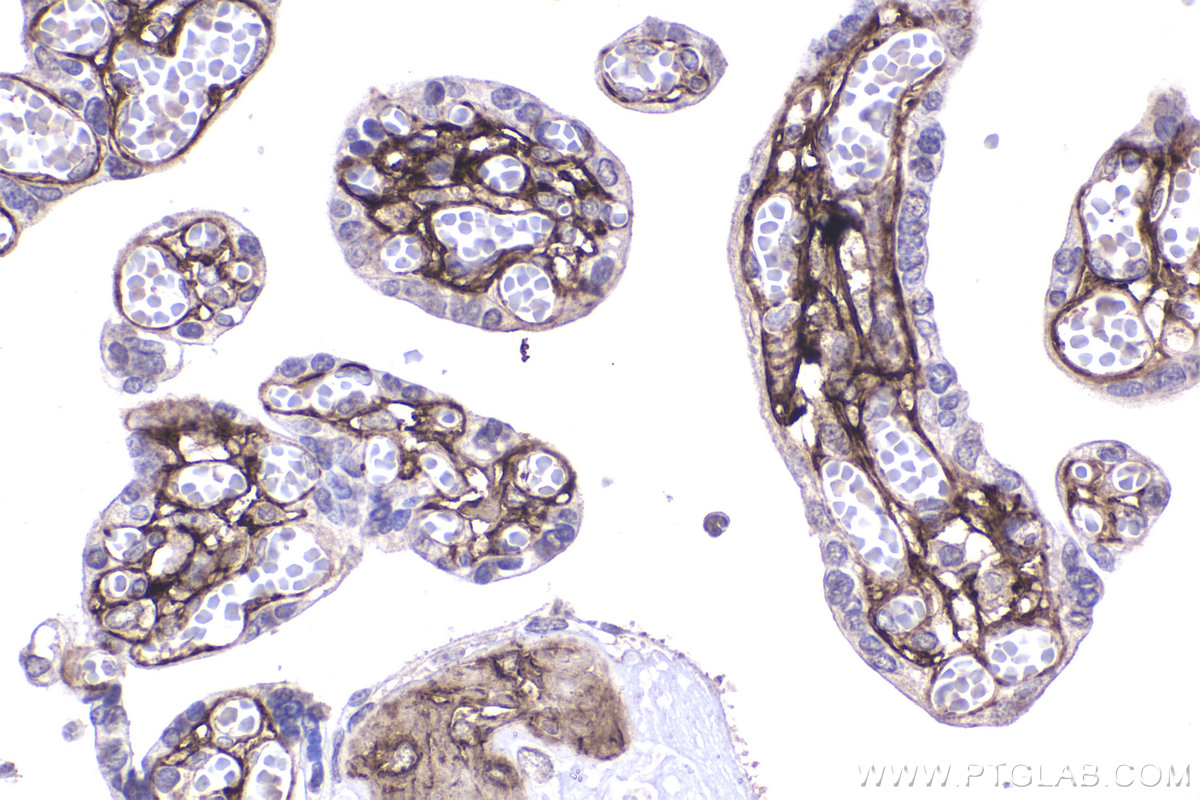 IHC staining of human placenta using 68320-1-Ig (same clone as 68320-1-PBS)