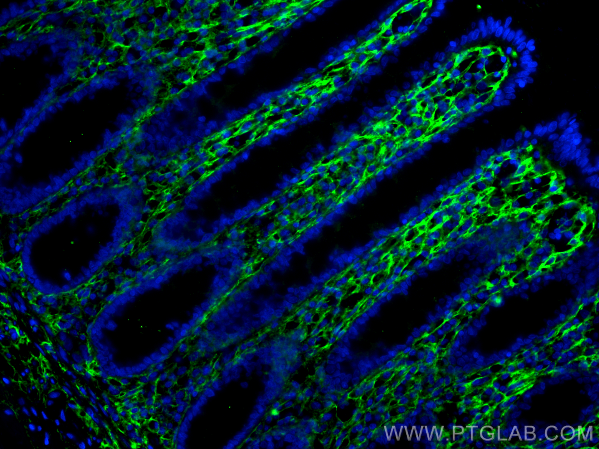 IF Staining of human colon using 80009-1-RR