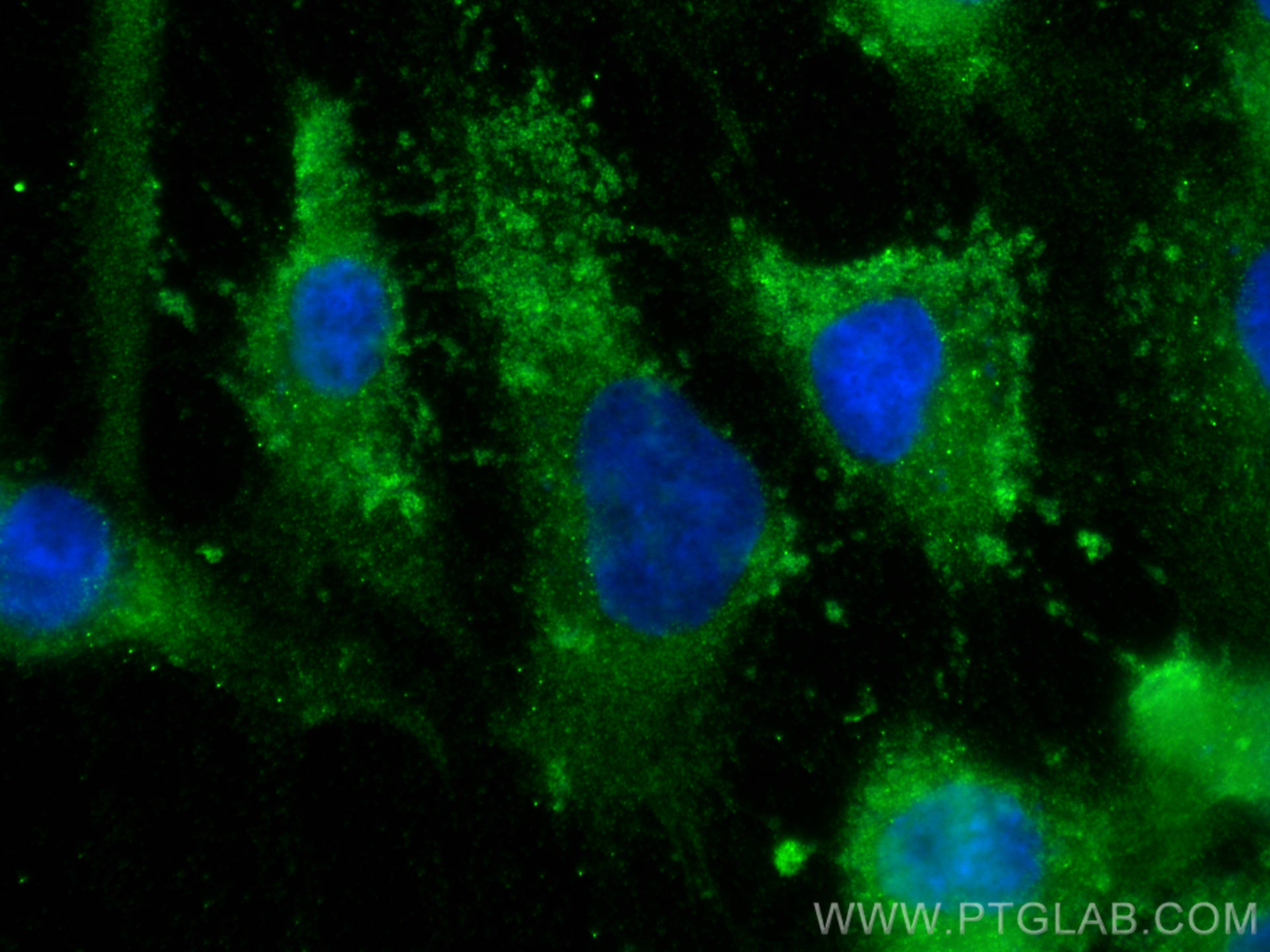 IF Staining of HUVEC using 30204-1-AP (same clone as 30204-1-PBS)