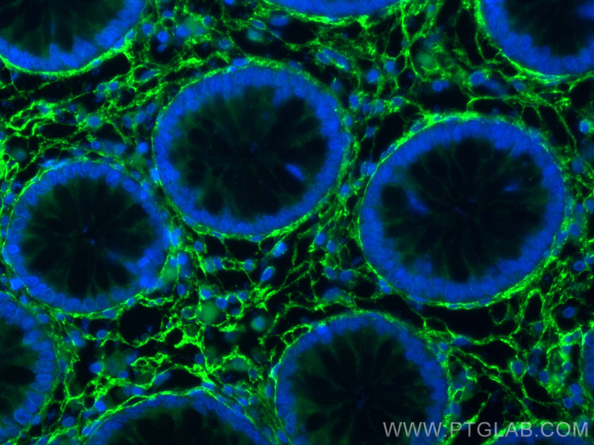 IF Staining of human colon using 17023-1-AP