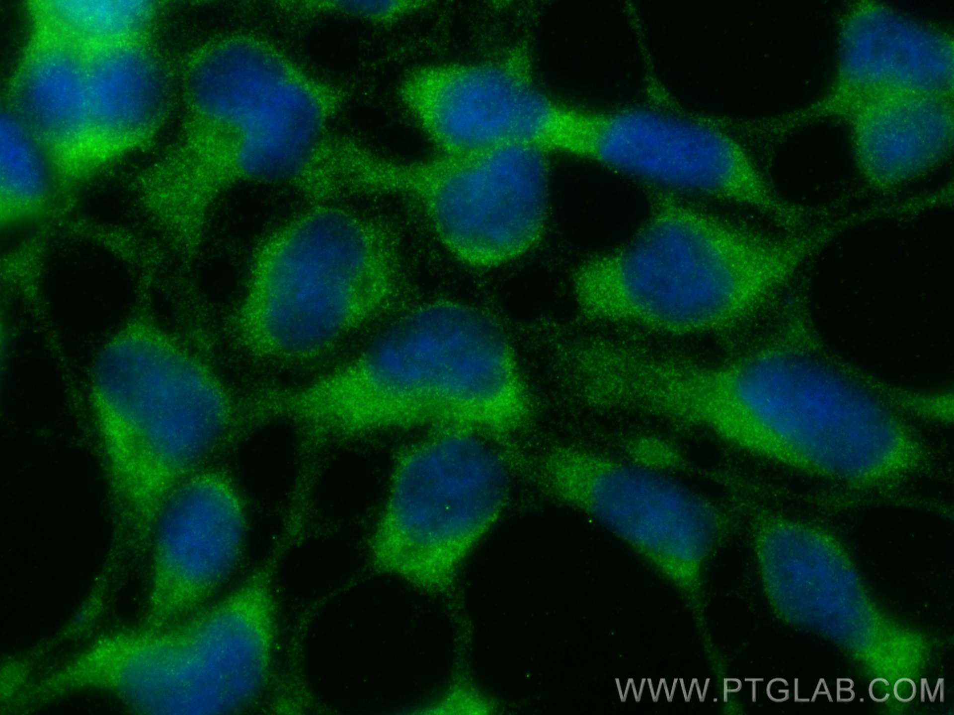 IF Staining of HEK-293 using 25237-1-AP