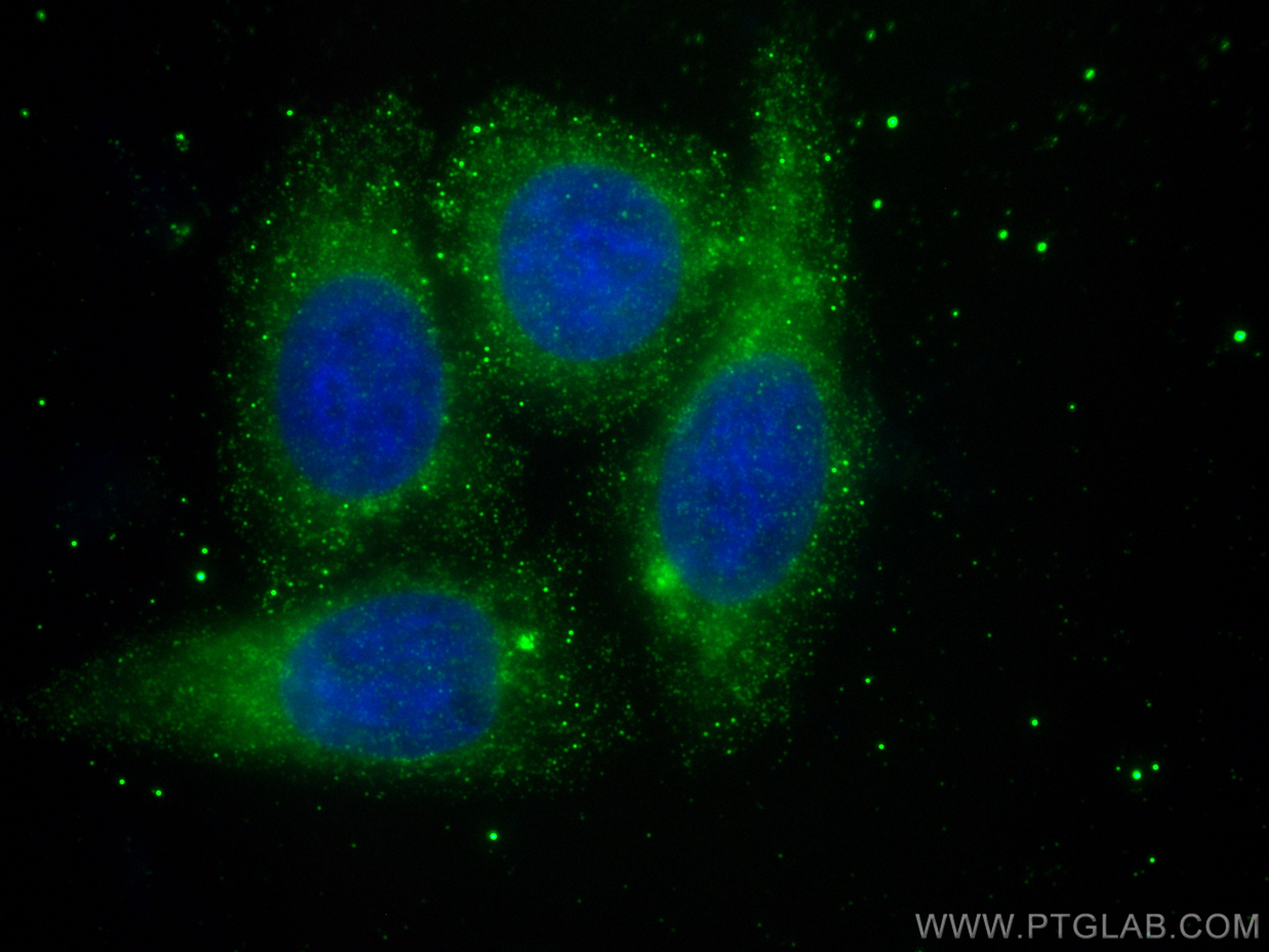 IF Staining of HepG2 using 28369-1-AP