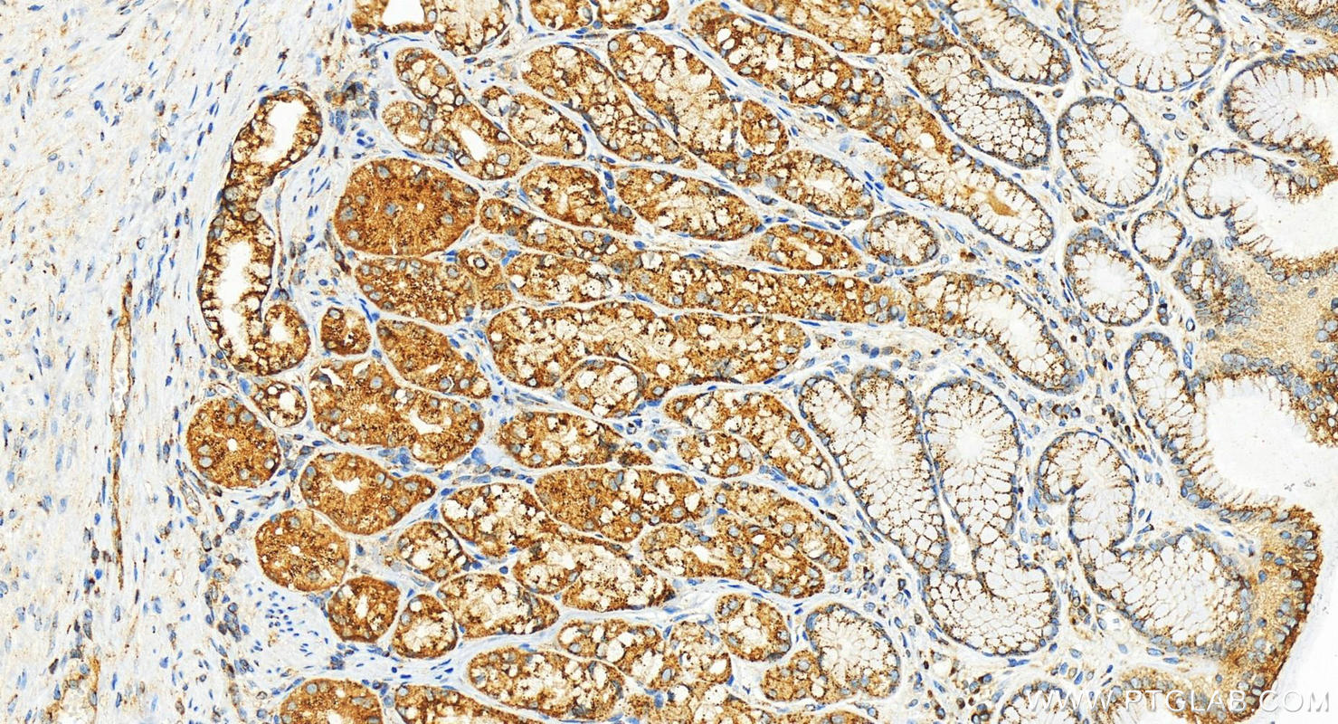 IHC staining of human stomach using 83089-1-RR