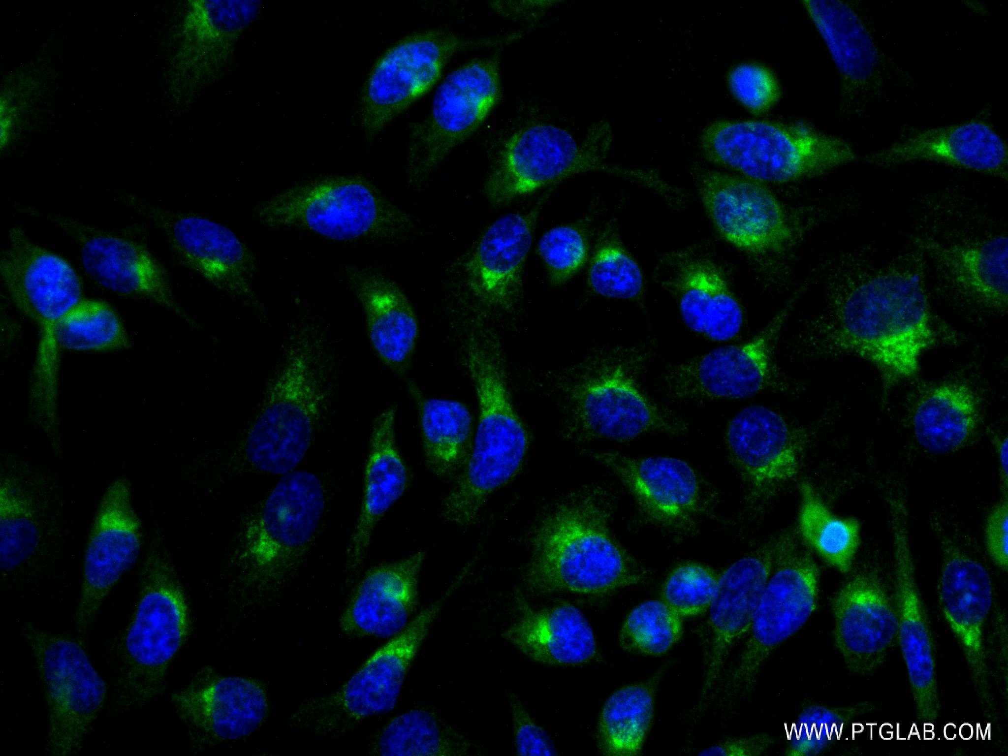 IF Staining of HeLa using 83089-1-RR