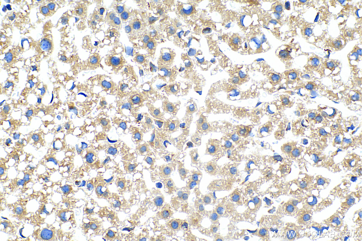 IHC staining of mouse liver using 83089-1-RR