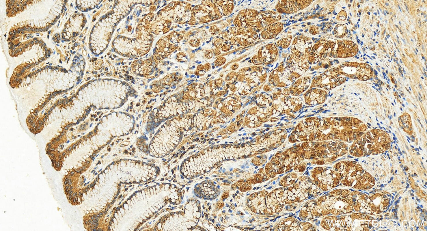 IHC staining of human stomach using 27469-1-AP