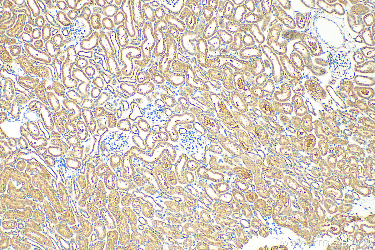 IHC staining of mouse kidney using 12393-1-AP