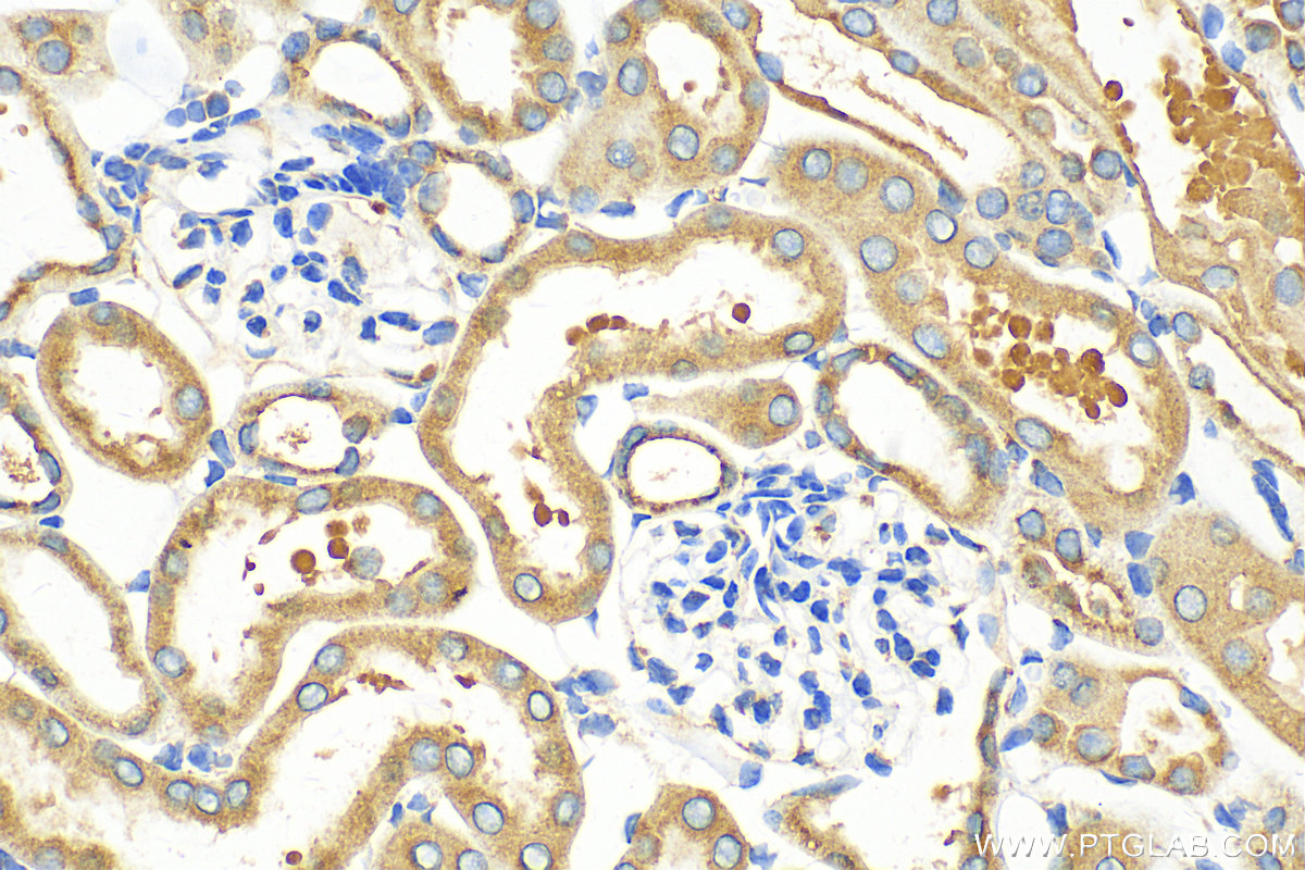 IHC staining of mouse kidney using 12393-1-AP