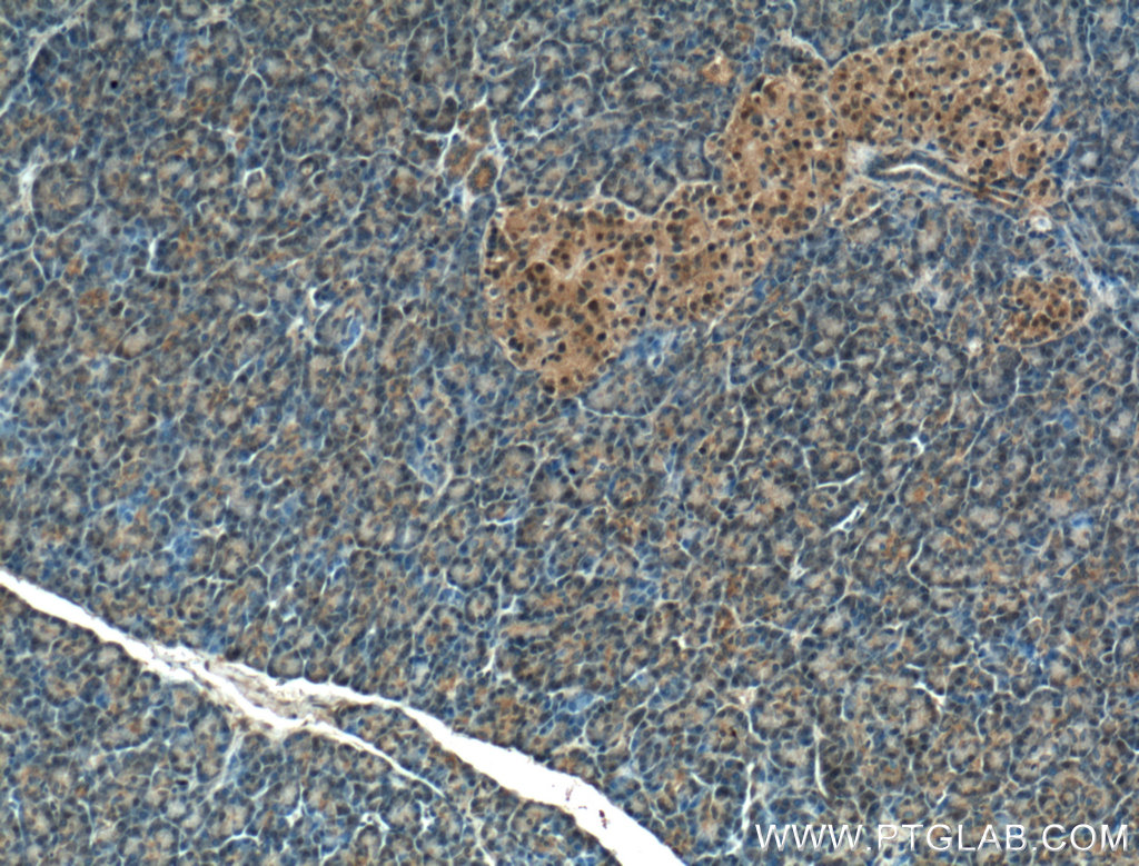 IHC staining of human pancreas using 10464-1-AP