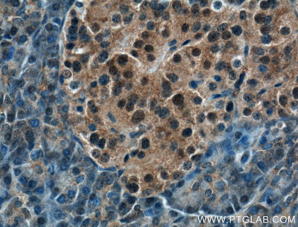 IHC staining of human pancreas using 10464-1-AP