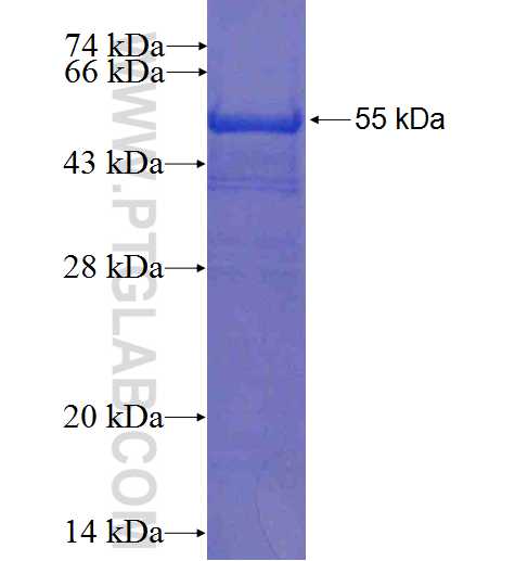 COPS4 fusion protein Ag0735 SDS-PAGE