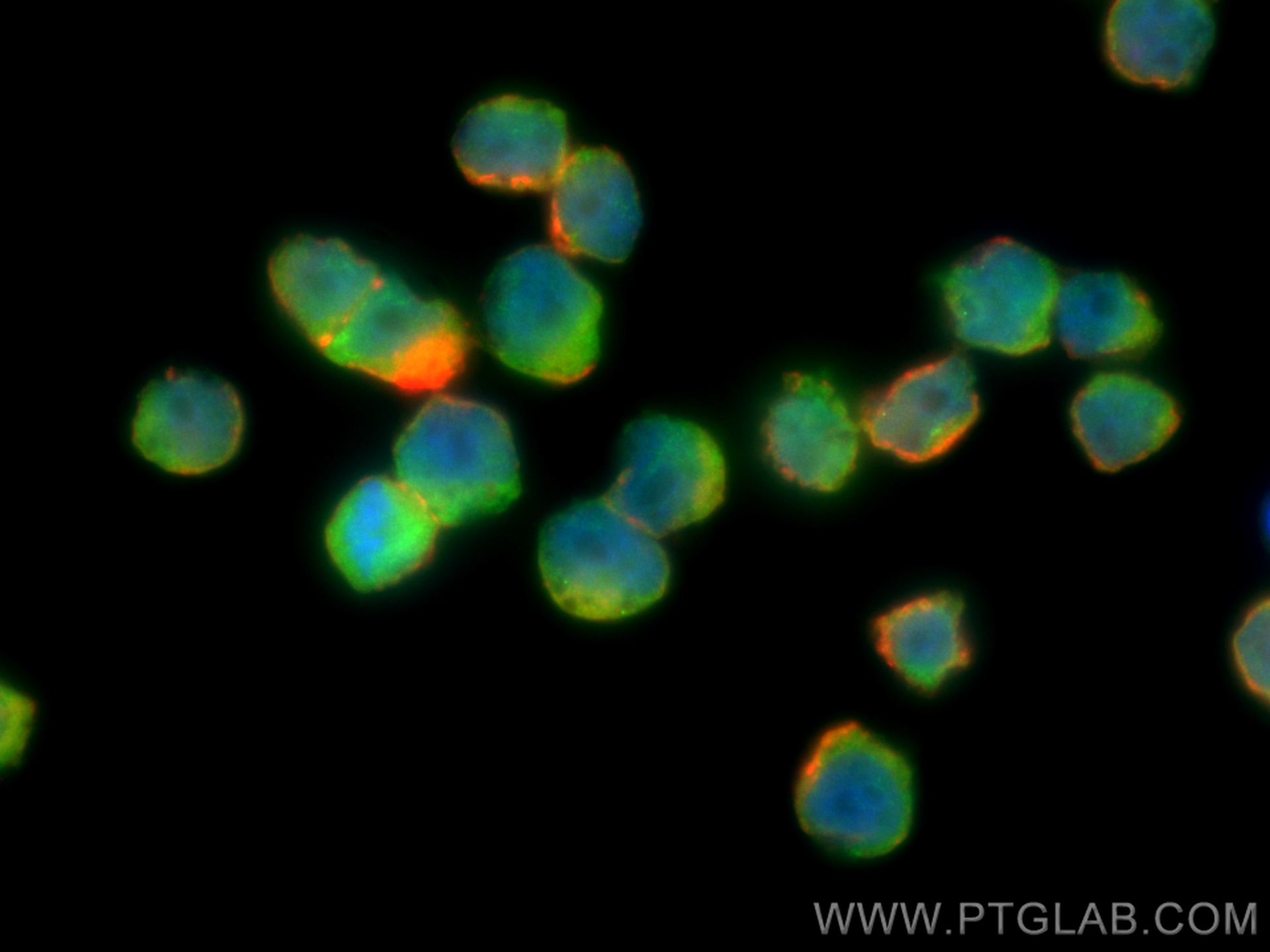 IF Staining of COLO 320 using 10256-1-AP (same clone as 10256-1-PBS)