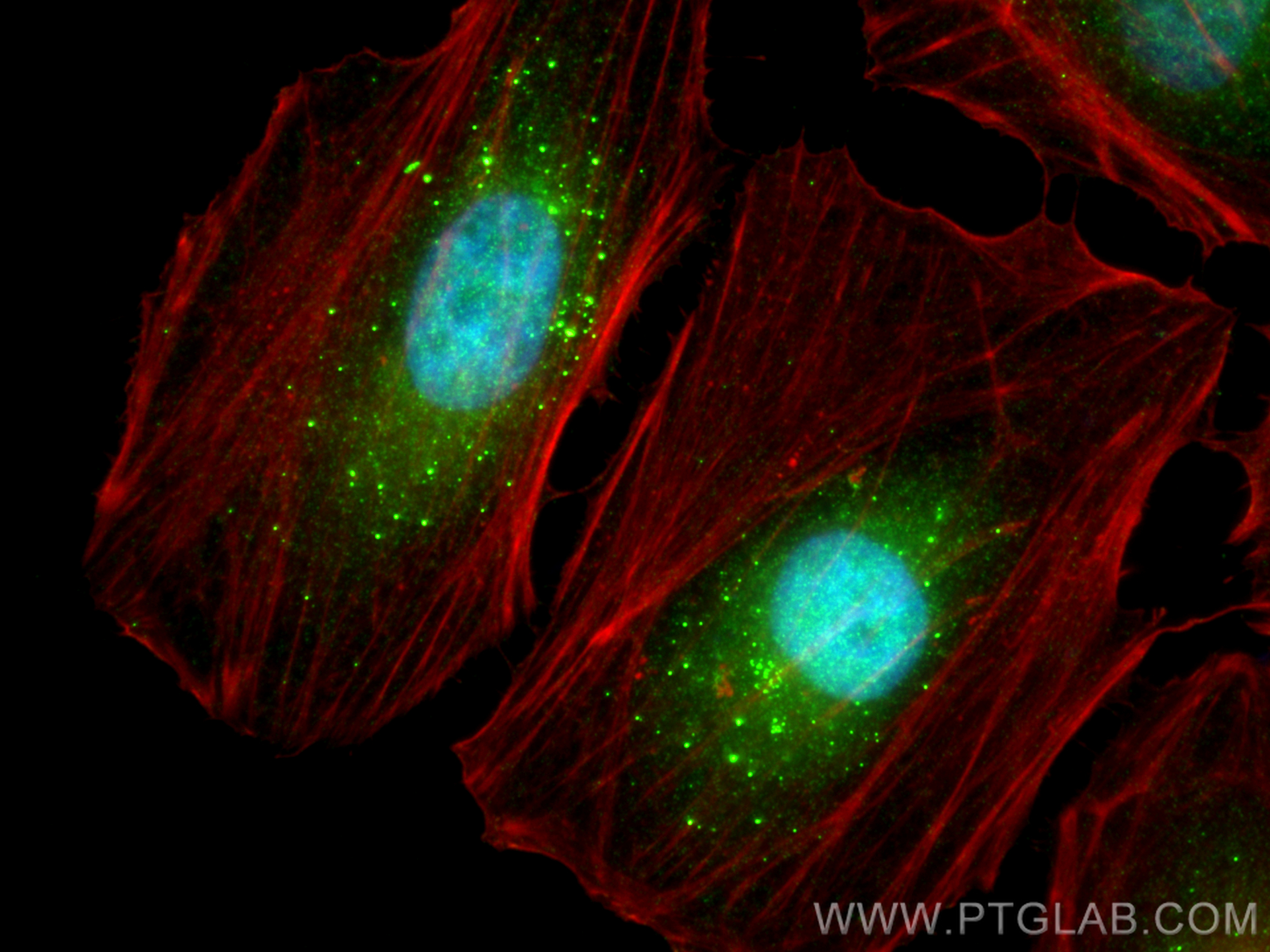 IF Staining of HeLa using 10256-1-AP