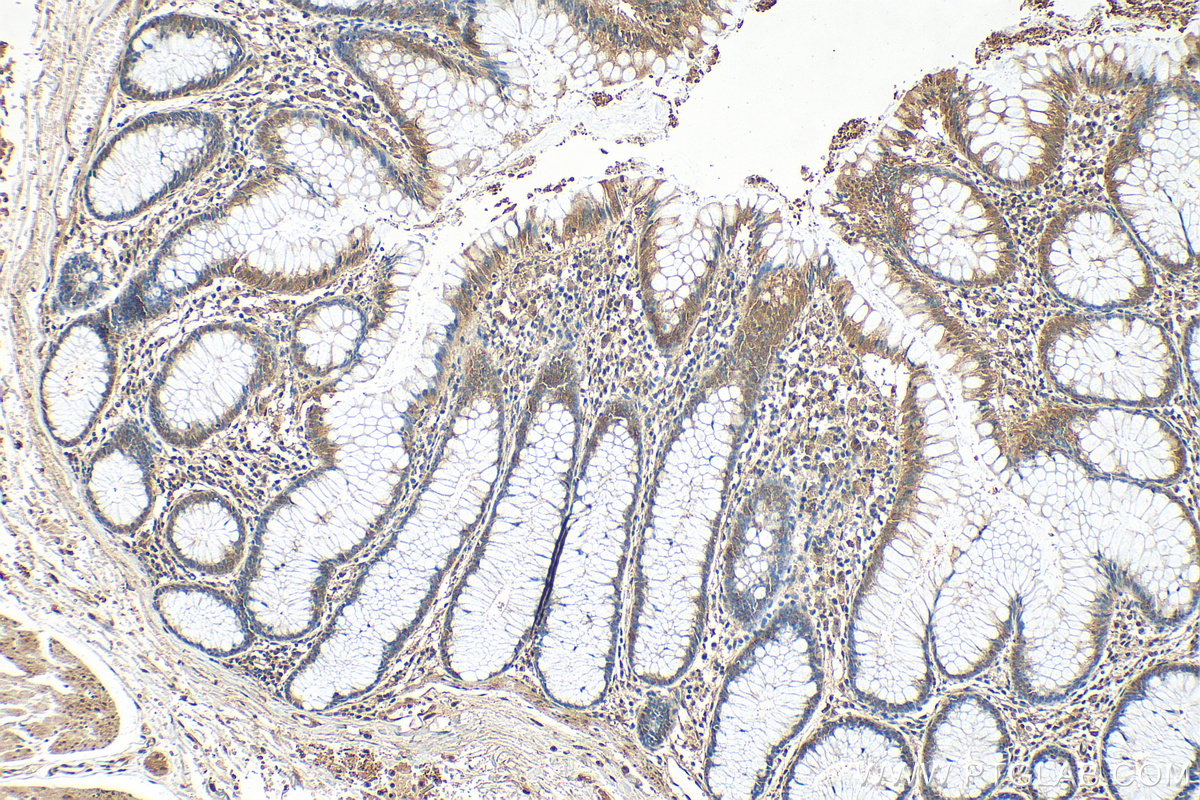 IHC staining of human colon using 10256-1-AP (same clone as 10256-1-PBS)