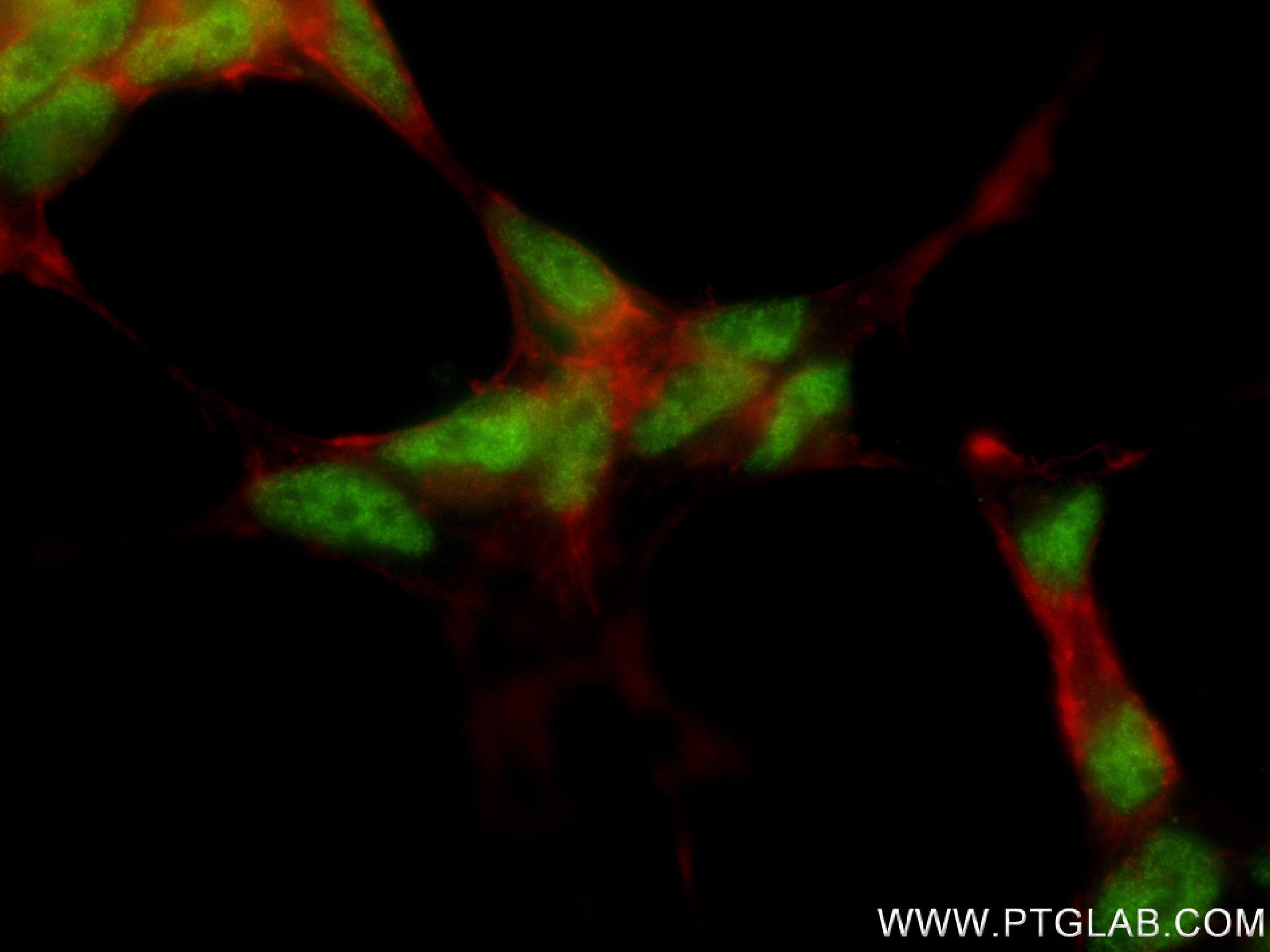 IF Staining of SH-SY5Y using 83312-1-RR