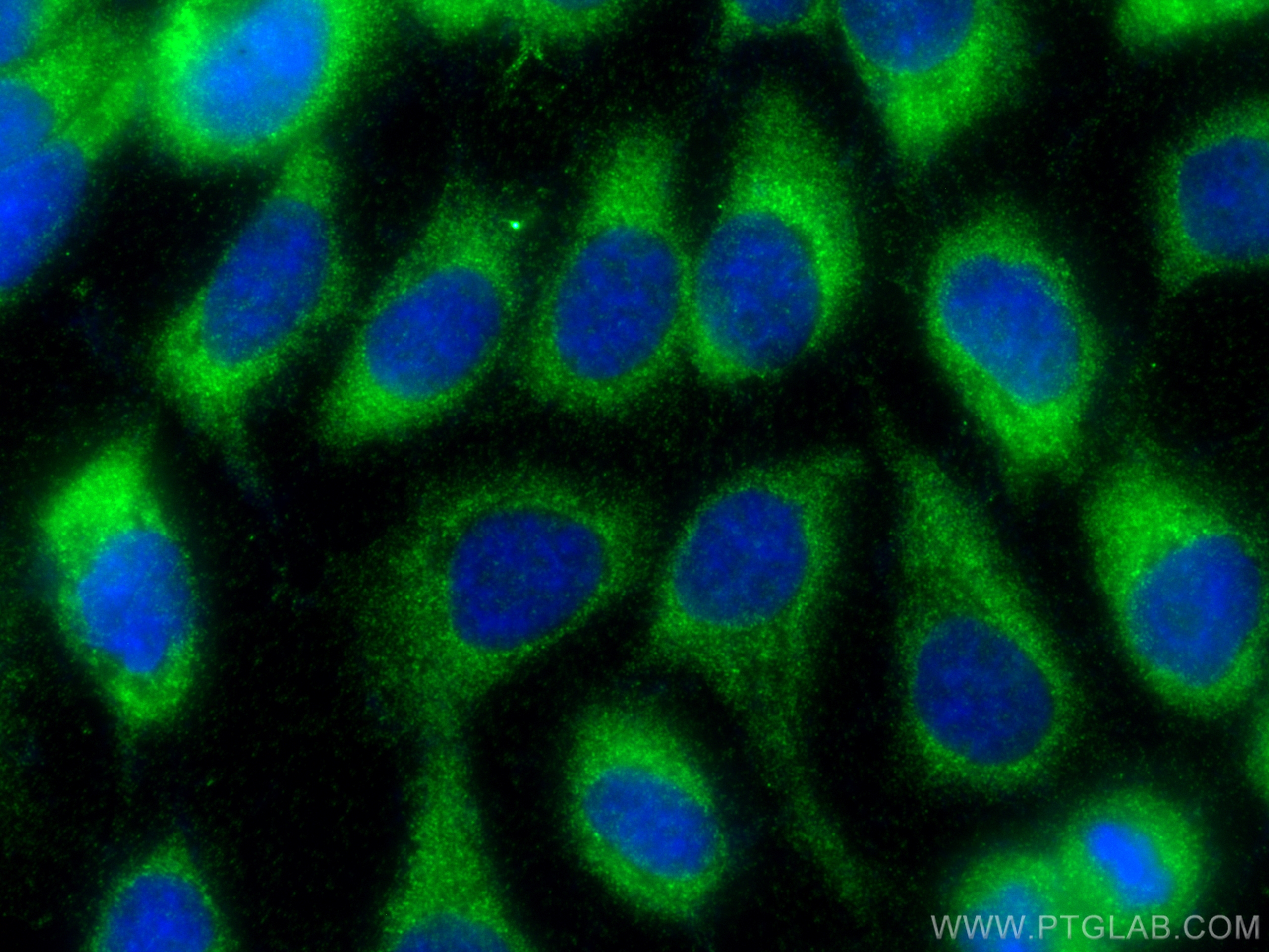 IF Staining of A431 using 17269-1-AP