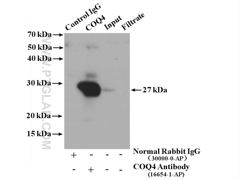 IP experiment of mouse liver using 16654-1-AP