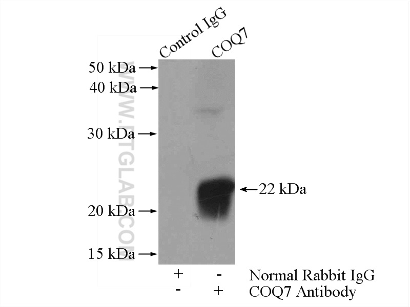 IP experiment of mouse liver using 15083-1-AP