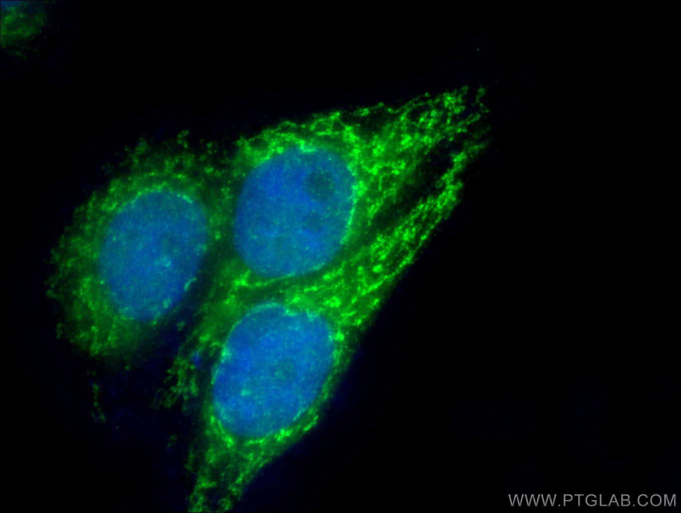 IF Staining of HepG2 using 14874-1-AP