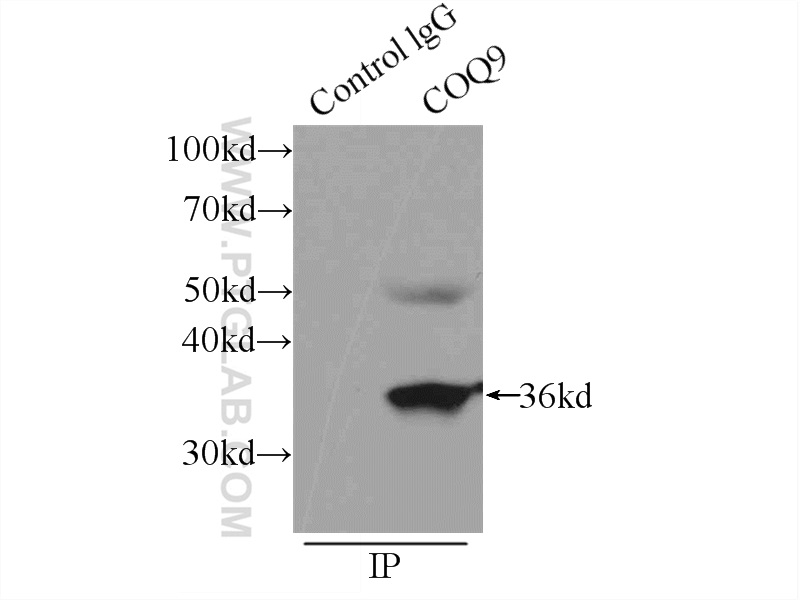 IP experiment of HeLa using 14874-1-AP