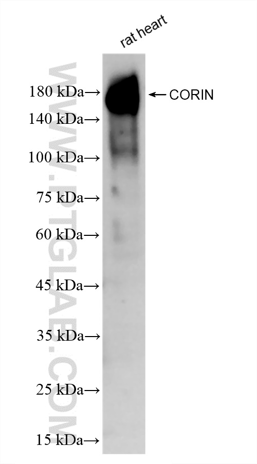 WB analysis of rat heart using 83566-1-RR (same clone as 83566-1-PBS)