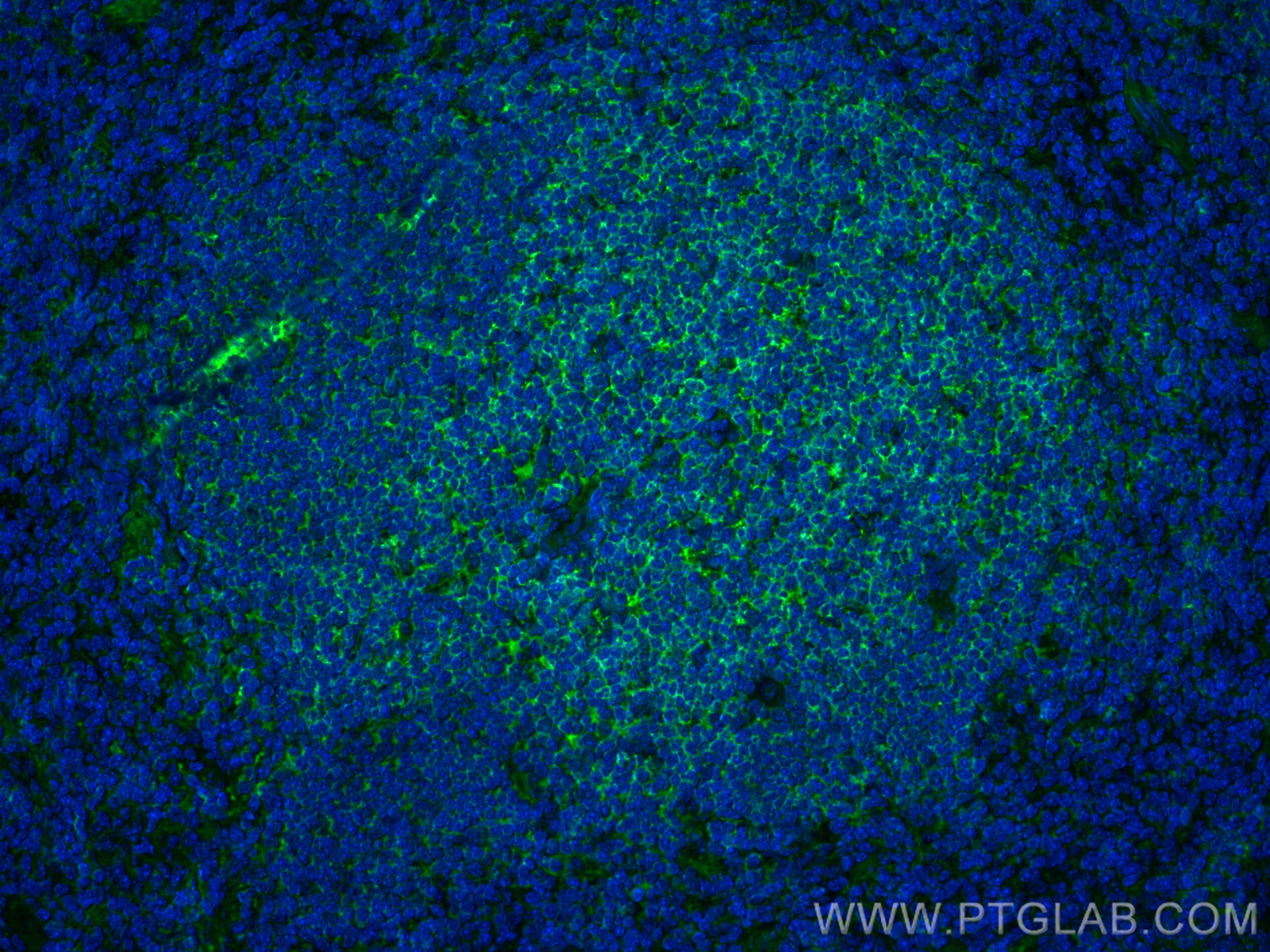 IF Staining of mouse spleen using 17760-1-AP