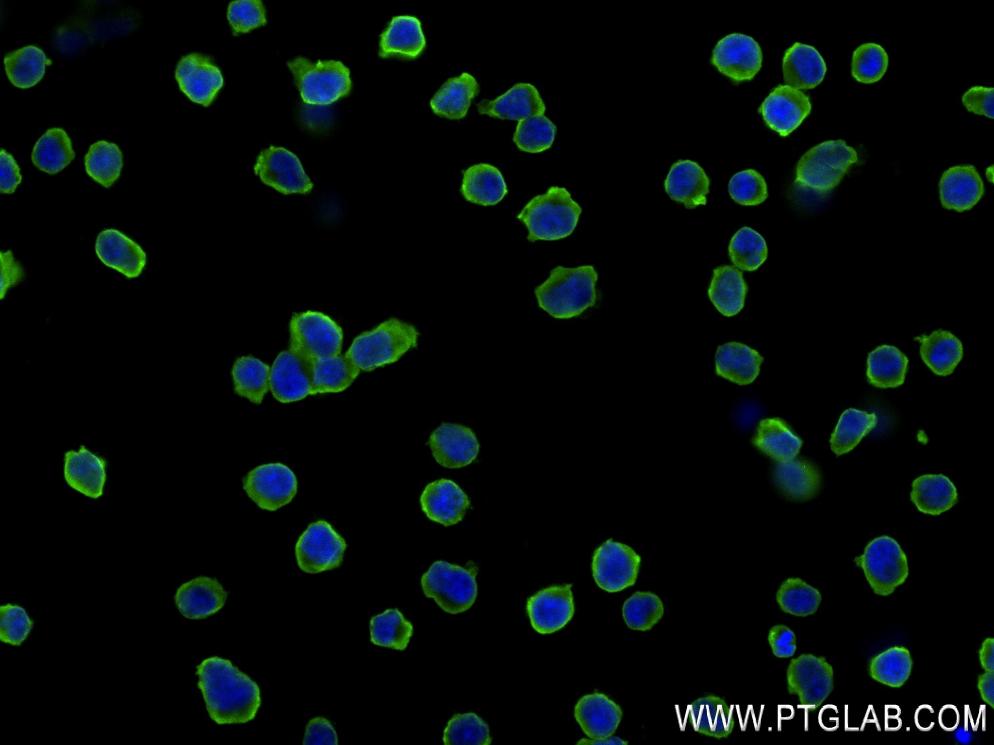 IF Staining of Jurkat using 84602-5-RR (same clone as 84602-5-PBS)