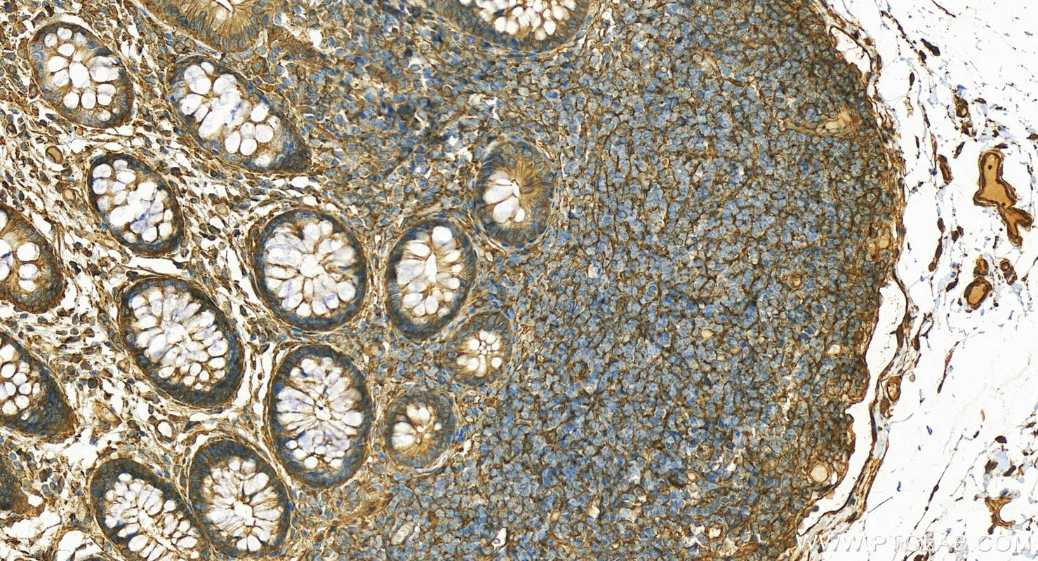 IHC staining of human normal colon using 14749-1-AP