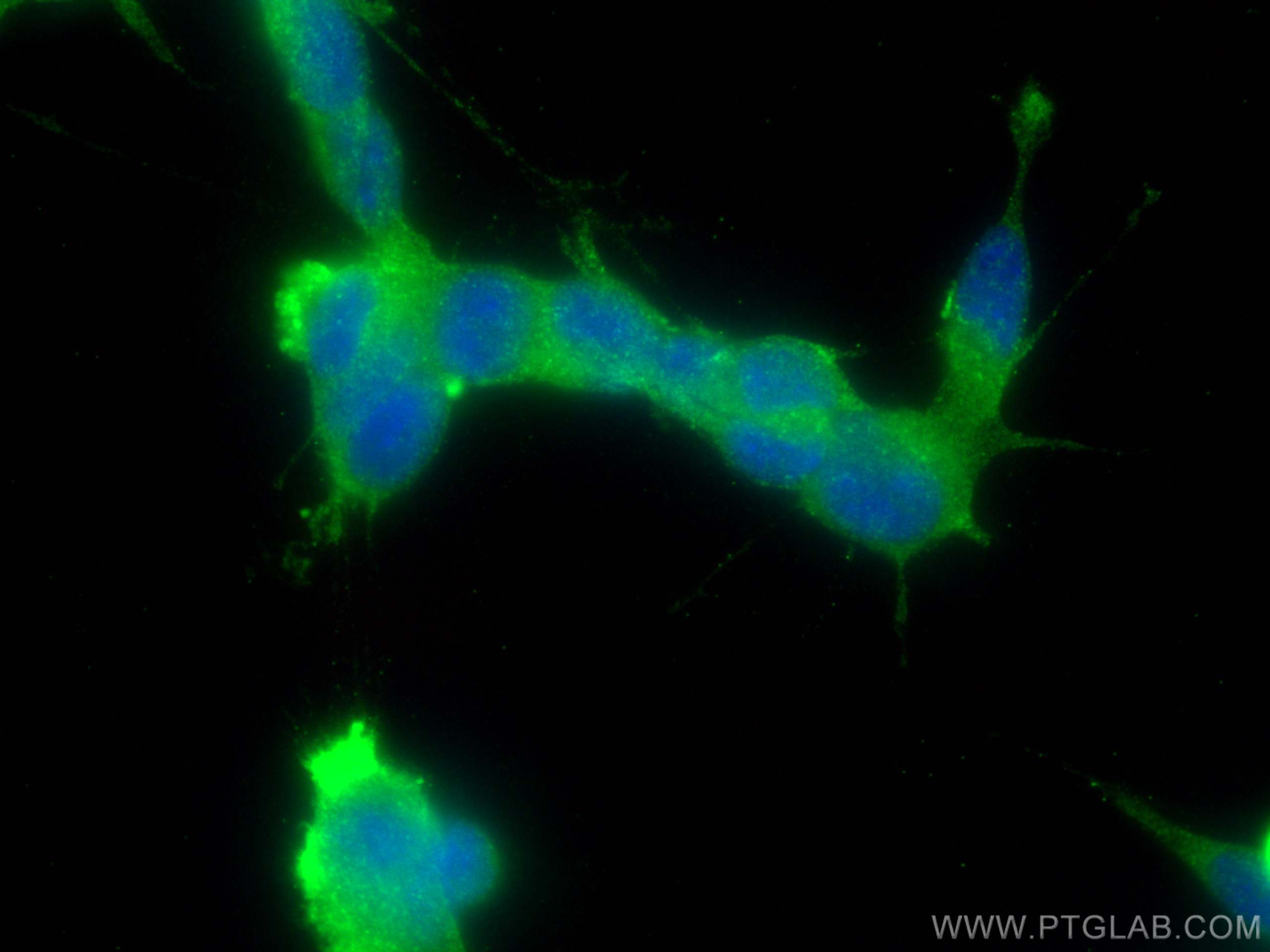 IF Staining of SH-SY5Y using 14749-1-AP