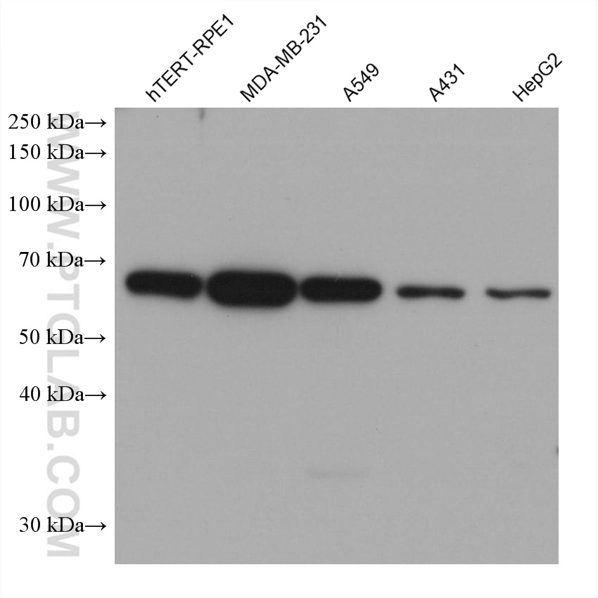 WB analysis using 68846-1-Ig