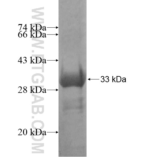 CORO6 fusion protein Ag11144 SDS-PAGE