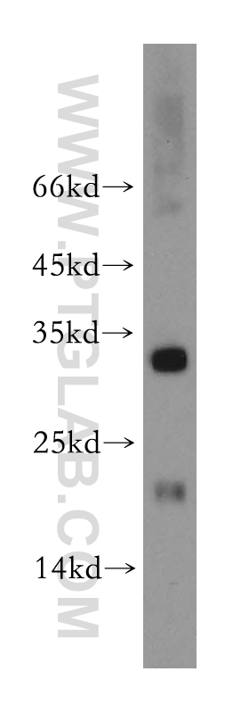 WB analysis of mouse liver using 11498-1-AP