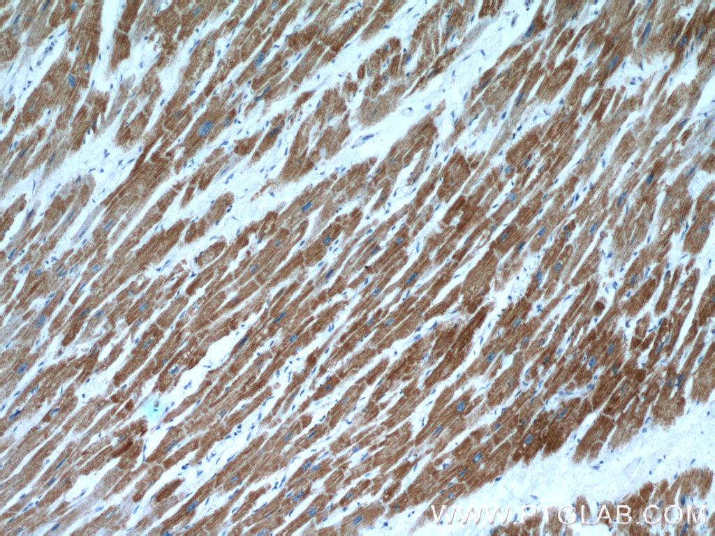 IHC staining of human heart using 11441-1-AP