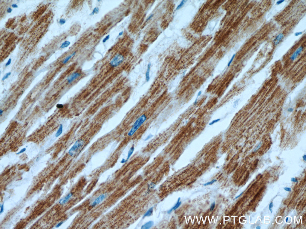 IHC staining of human heart using 11441-1-AP