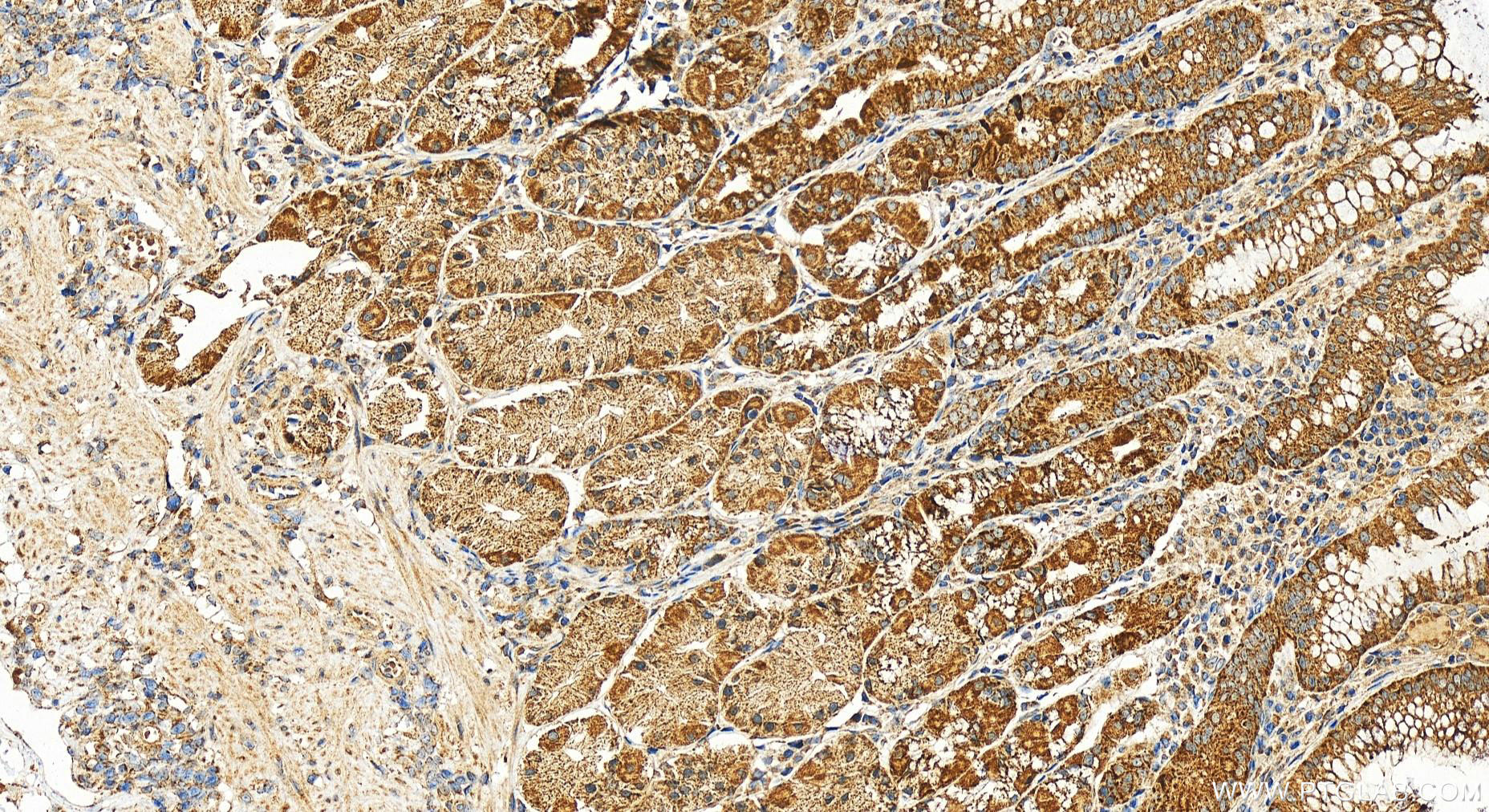 IHC staining of human stomach using 19425-1-AP