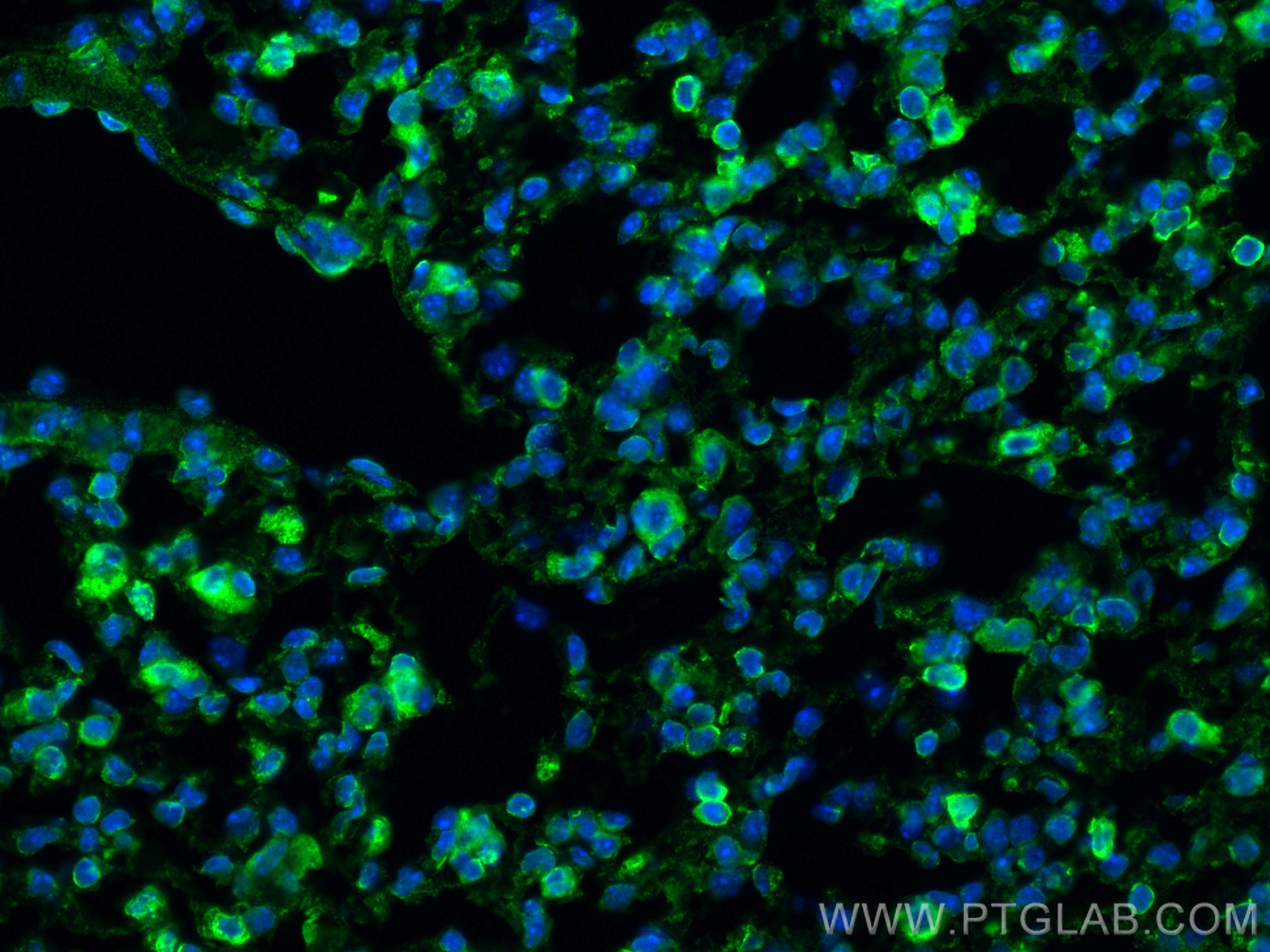 IF Staining of mouse lung using 27308-1-AP