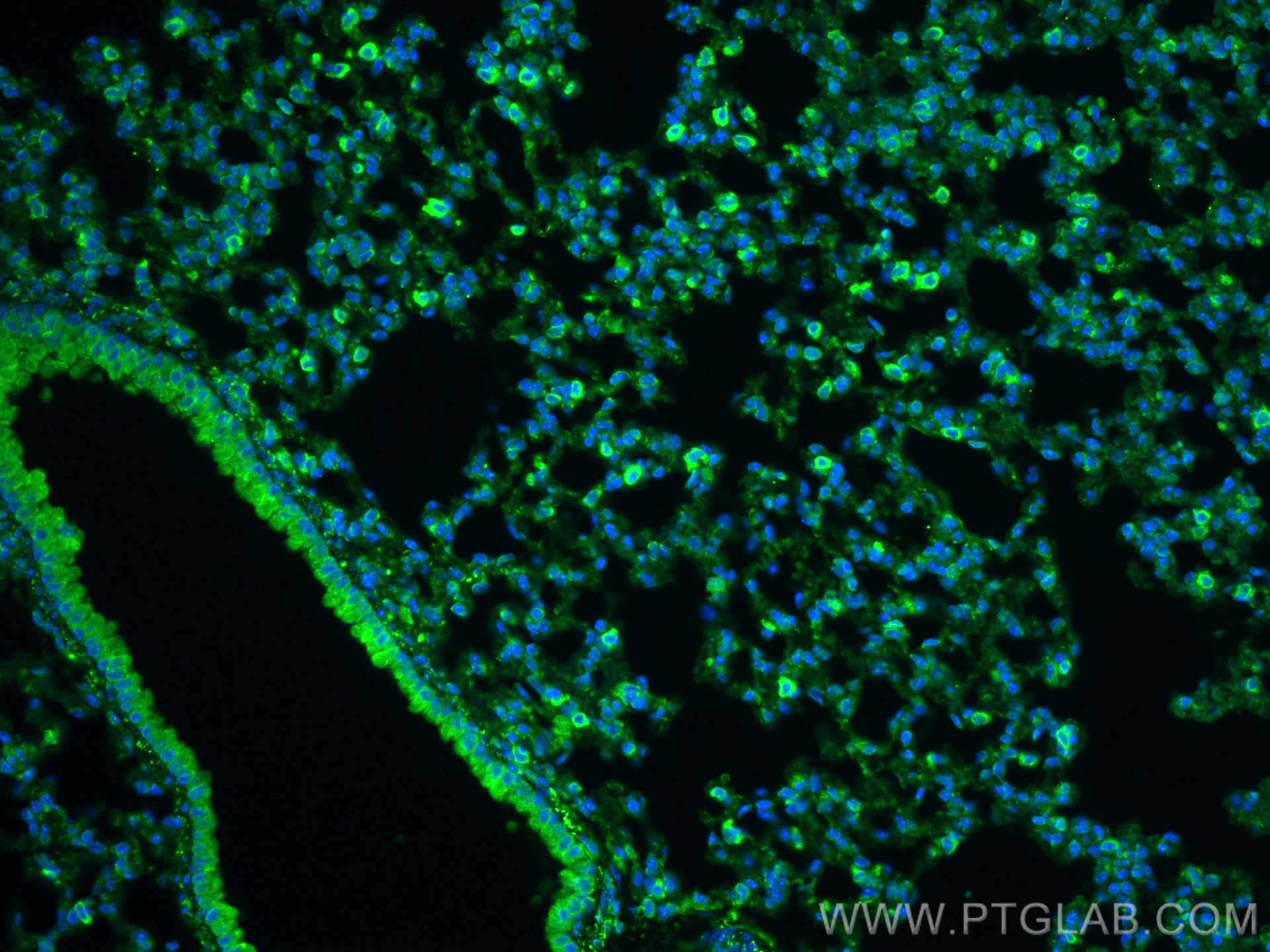 IF Staining of mouse lung using 27308-1-AP