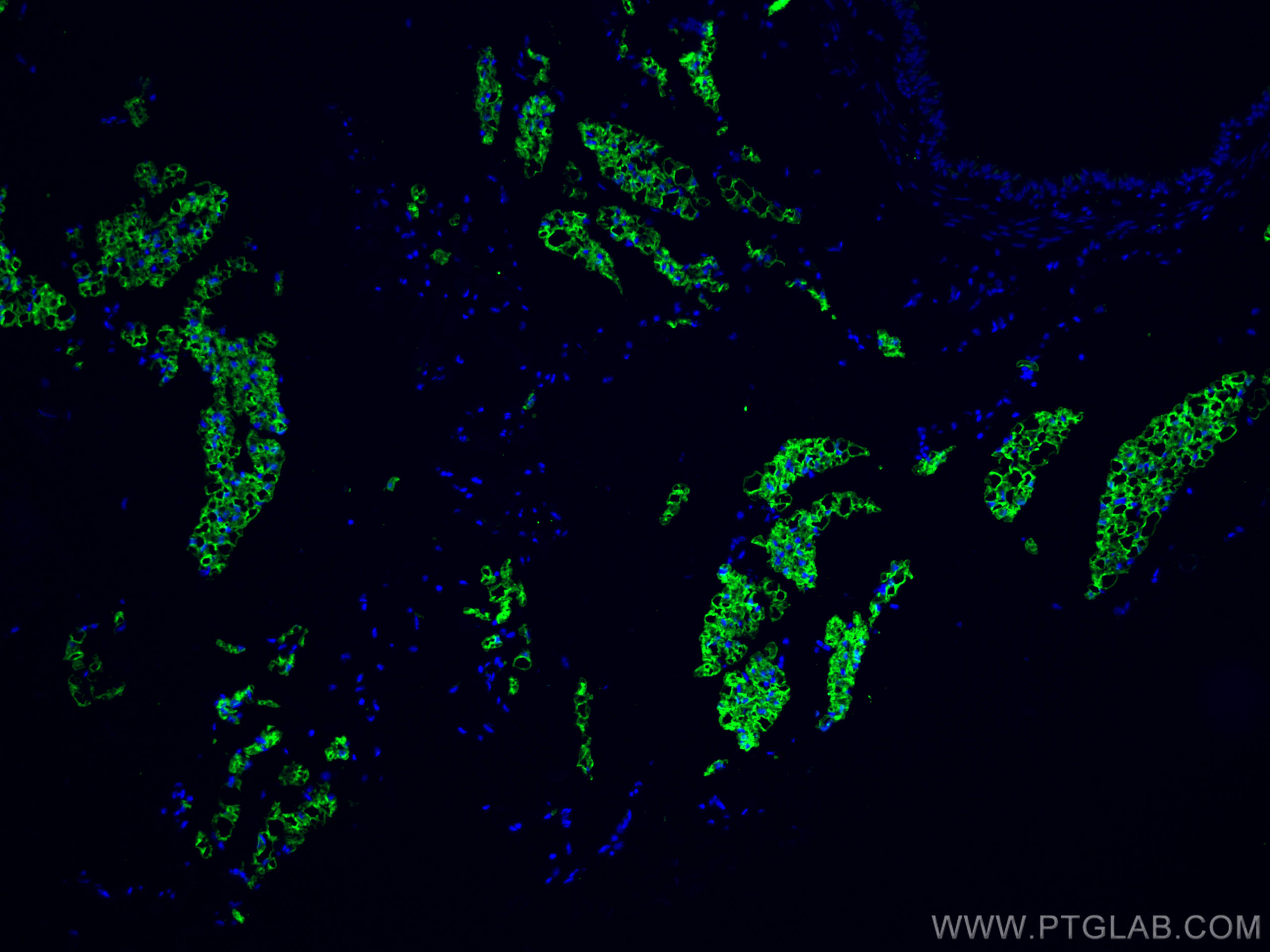 COX2/ Cyclooxygenase 2/ PTGS2